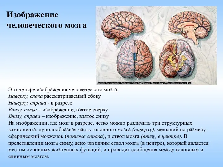 Это четыре изображения человеческого мозга. Наверху, слева рассматриваемый сбоку Наверху,