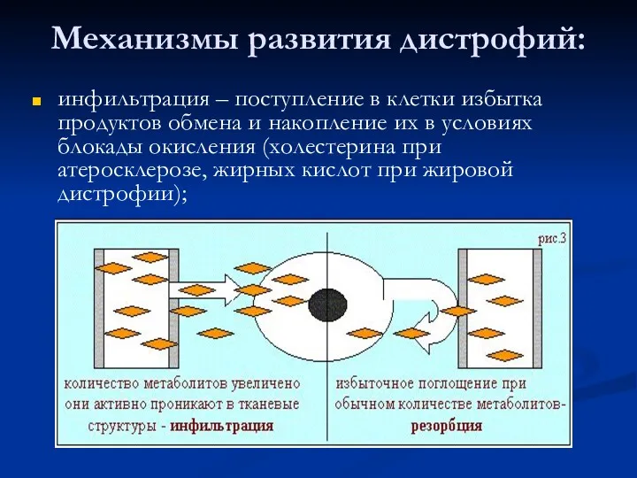 Механизмы развития дистрофий: инфильтрация – поступление в клетки избытка продуктов