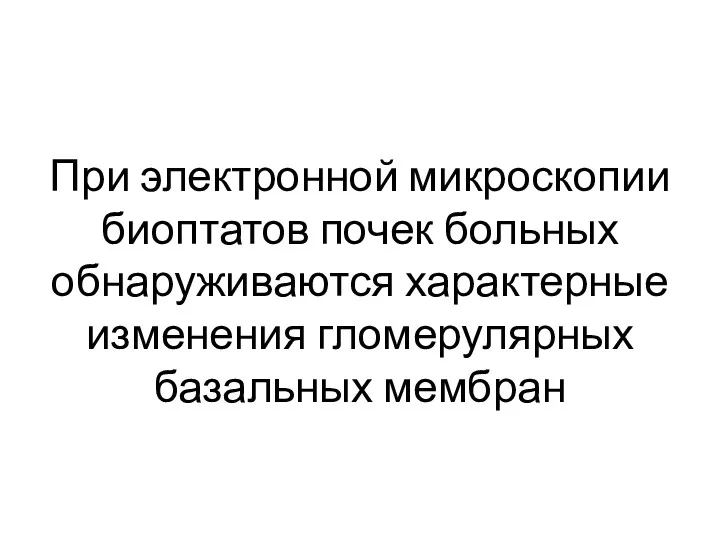 При электронной микроскопии биоптатов почек больных обнаруживаются характерные изменения гломерулярных базальных мембран