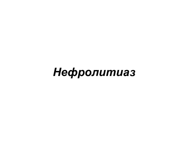 Нефролитиаз