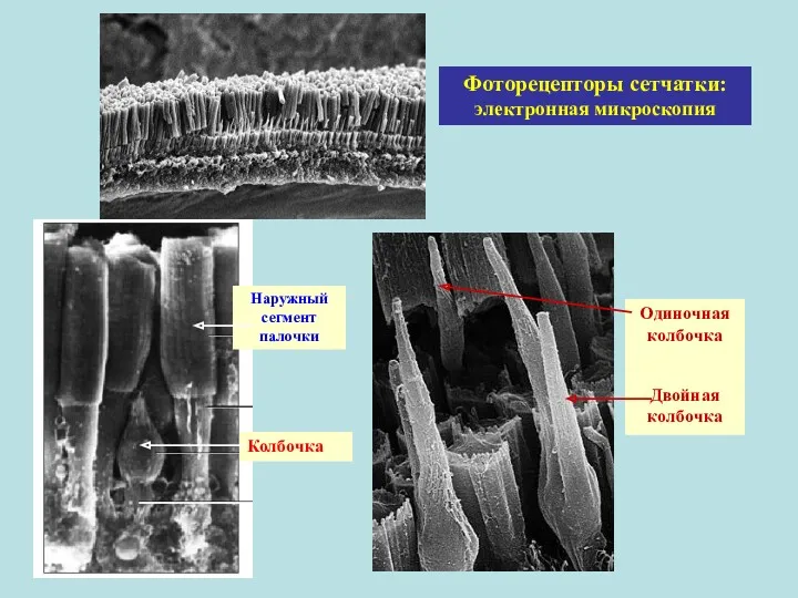 Наружный сегмент палочки Одиночная колбочка Двойная колбочка Колбочка Фоторецепторы сетчатки: электронная микроскопия