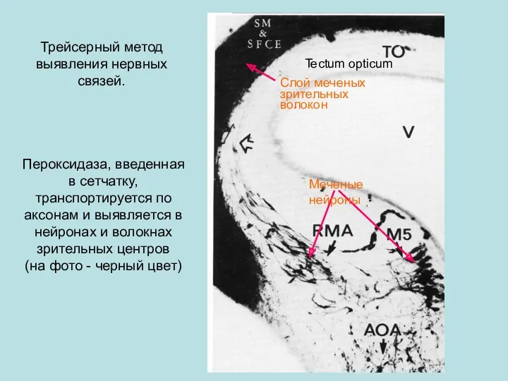 Трейсерный метод выявления нервных связей. Пероксидаза, введенная в сетчатку, транспортируется