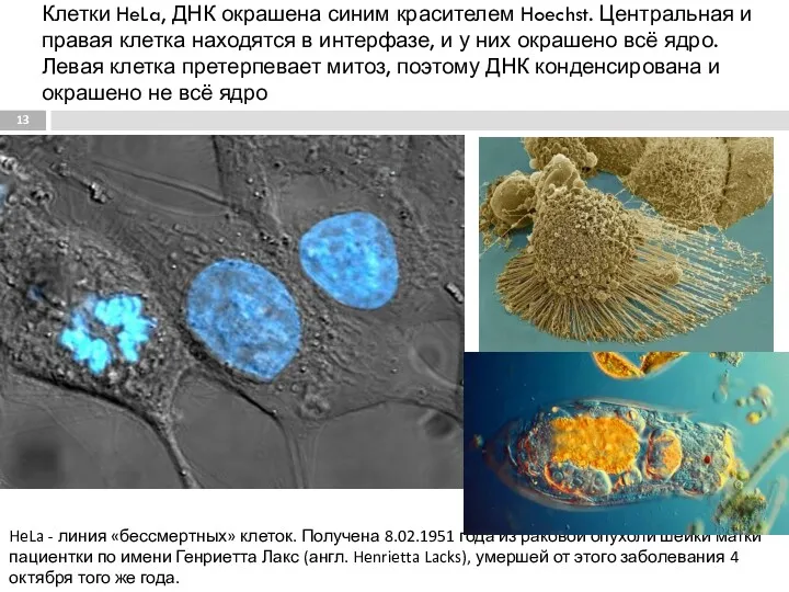 Клетки HeLa, ДНК окрашена синим красителем Hoechst. Центральная и правая