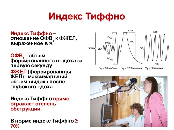 Индекс Тиффно Индекс Тиффно – отношение ОФВ1 к ФЖЕЛ, выраженное