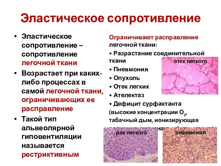 Эластическое сопротивление Эластическое сопротивление – сопротивление легочной ткани Возрастает при