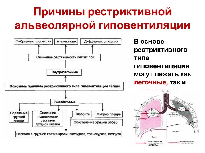 Причины рестриктивной альвеолярной гиповентиляции В основе рестриктивного типа гиповентиляции могут