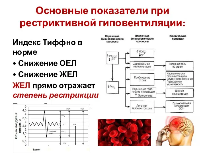 Основные показатели при рестриктивной гиповентиляции: Индекс Тиффно в норме •