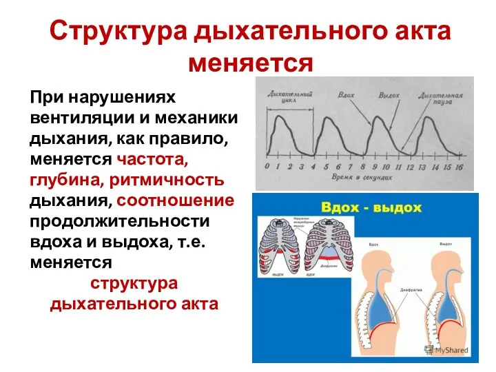 Структура дыхательного акта меняется При нарушениях вентиляции и механики дыхания,