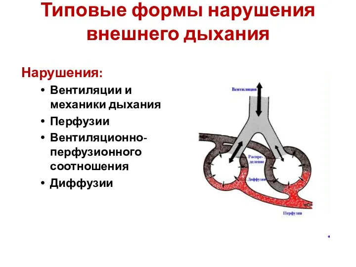 Типовые формы нарушения внешнего дыхания Нарушения: Вентиляции и механики дыхания Перфузии Вентиляционно-перфузионного соотношения Диффузии