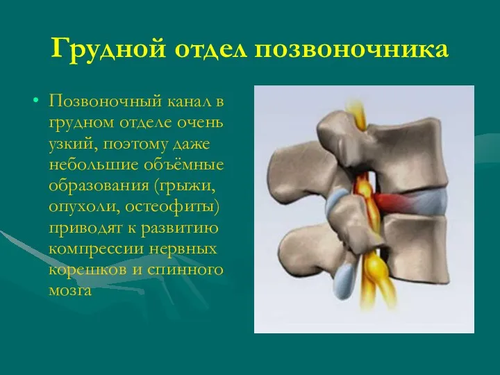 Грудной отдел позвоночника Позвоночный канал в грудном отделе очень узкий,