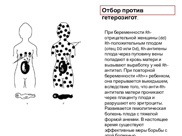 Отбор против гетерозигот. При беременности Rh-отрицательной женщины (dd) Rh-положительным плодом