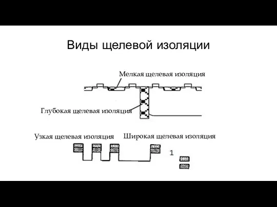 Виды щелевой изоляции Мелкая щелевая изоляция Глубокая щелевая изоляция Широкая щелевая изоляция Узкая щелевая изоляция