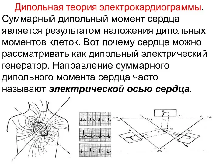 Дипольная теория электрокардиограммы. Суммарный дипольный момент сердца является результатом наложения