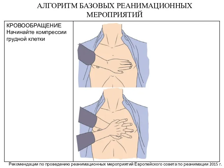 АЛГОРИТМ БАЗОВЫХ РЕАНИМАЦИОННЫХ МЕРОПРИЯТИЙ Рекомендации по проведению реанимационных мероприятий Европейского совета по реанимации 2015 г.