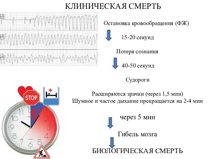 КЛИНИЧЕСКАЯ СМЕРТЬ Остановка кровообращения (ФЖ) 15-20 секунд Потеря сознания 40-50 секунд Судороги Расширяются