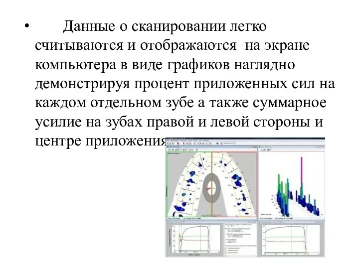 Данные о сканировании легко считываются и отображаются на экране компьютера в виде графиков