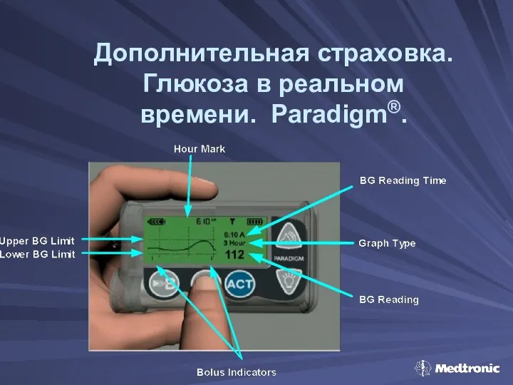 Дополнительная страховка. Глюкоза в реальном времени. Paradigm®.