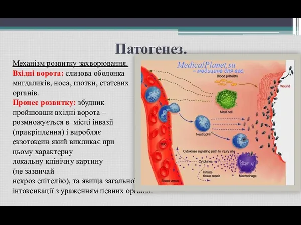 Патогенез. Механізм розвитку захворювання. Вхідні ворота: слизова оболонка мигдаликів, носа,