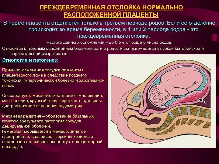В норме плацента отделяется только в третьем периоде родов. Если ее отделение происходит