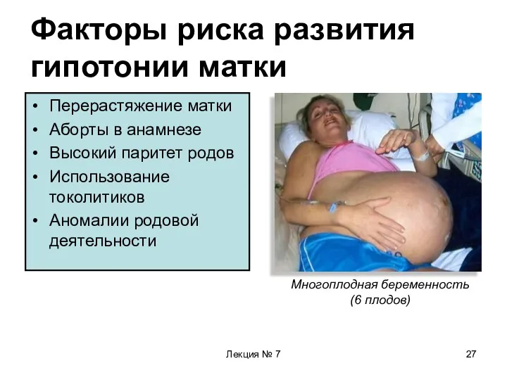 Лекция № 7 Факторы риска развития гипотонии матки Перерастяжение матки