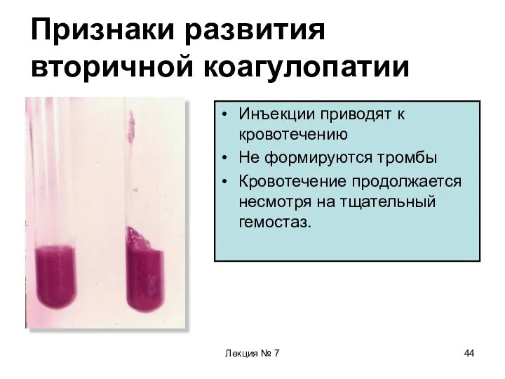 Лекция № 7 Признаки развития вторичной коагулопатии Инъекции приводят к кровотечению Не формируются