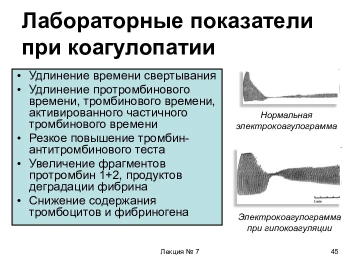 Лекция № 7 Лабораторные показатели при коагулопатии Удлинение времени свертывания