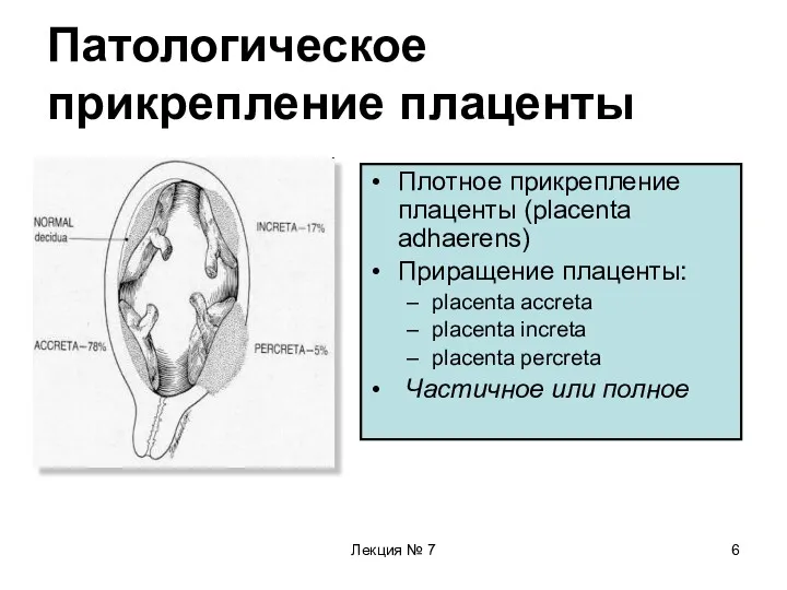 Лекция № 7 Патологическое прикрепление плаценты Плотное прикрепление плаценты (placenta