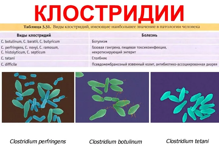 КЛОСТРИДИИ Clostridium perfringens Clostridium botulinum Clostridium tetani