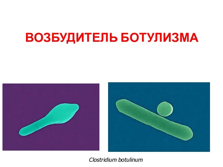 ВОЗБУДИТЕЛЬ БОТУЛИЗМА Clostridium botulinum