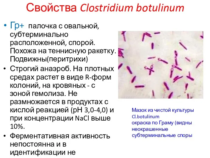 Свойства Clostridium botulinum Гр+ палочка с овальной, субтерминально расположенной, спорой.