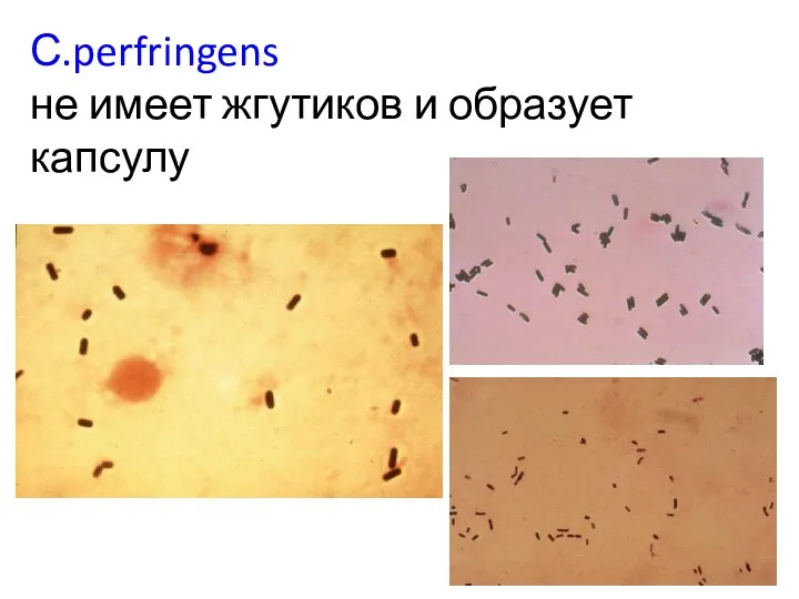 С.perfringens не имеет жгутиков и образует капсулу
