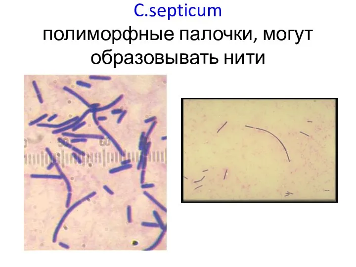 C.septicum полиморфные палочки, могут образовывать нити