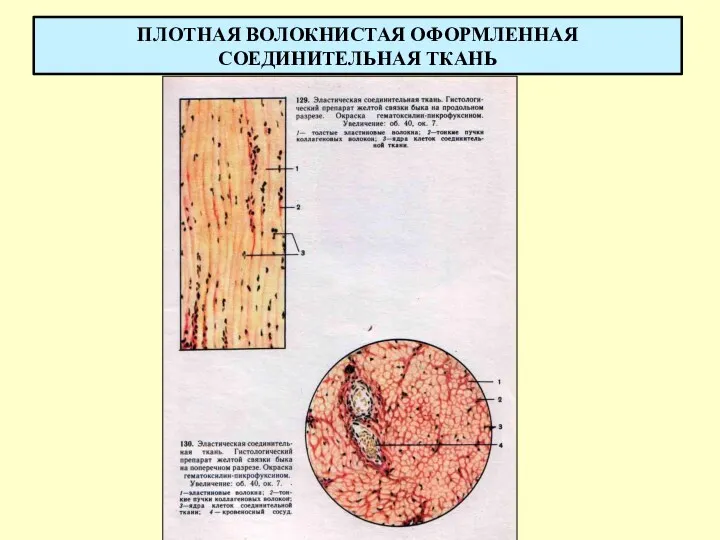 ПЛОТНАЯ ВОЛОКНИСТАЯ ОФОРМЛЕННАЯ СОЕДИНИТЕЛЬНАЯ ТКАНЬ