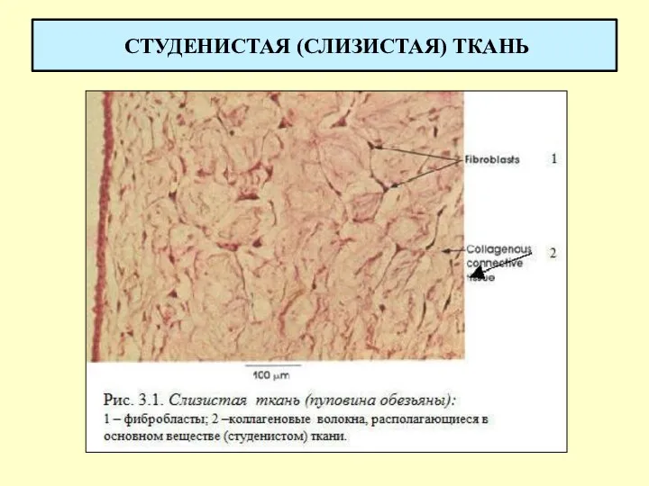 СТУДЕНИСТАЯ (СЛИЗИСТАЯ) ТКАНЬ