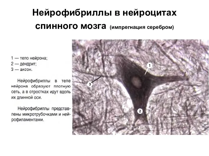 Нейрофибриллы в нейроцитах спинного мозга (импрегнация серебром)