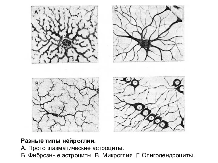 Разные типы нейроглии. А. Протоплазматические астроциты. Б. Фиброзные астроциты. В. Микроглия. Г. Олигодендроциты.