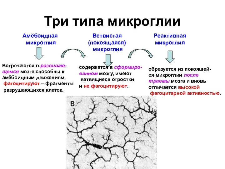 Три типа микроглии Амёбоидная микроглия Ветвистая (покоящаяся) микроглия Реактивная микроглия