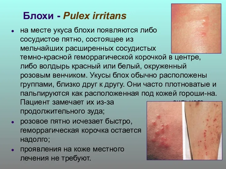 Блохи - Pulex irritans на месте укуса блохи появляются либо