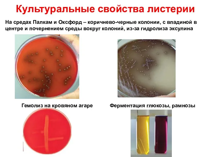 Культуральные свойства листерии На средах Палкам и Оксфорд – коричнево-черные