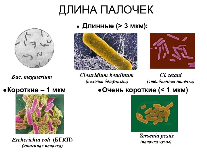 ДЛИНА ПАЛОЧЕК Длинные (> 3 мкм): Сlostridium botulinum (палочка ботулизма)