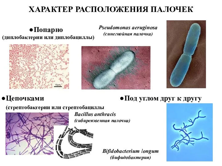 ХАРАКТЕР РАСПОЛОЖЕНИЯ ПАЛОЧЕК Попарно (диплобактерии или диплобациллы) Pseudomonas aeruginosa (синегнойная