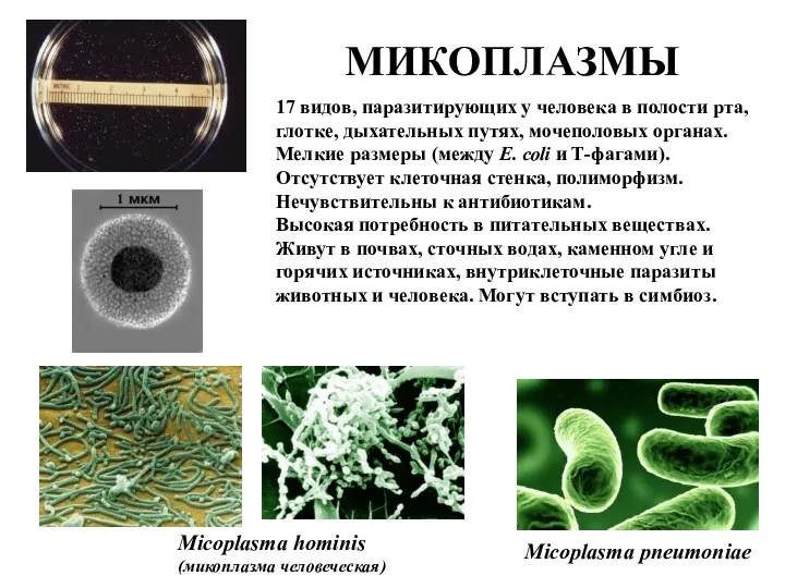 МИКОПЛАЗМЫ Micoplasma hominis (микоплазма человеческая) Micoplasma pneumoniae 17 видов, паразитирующих