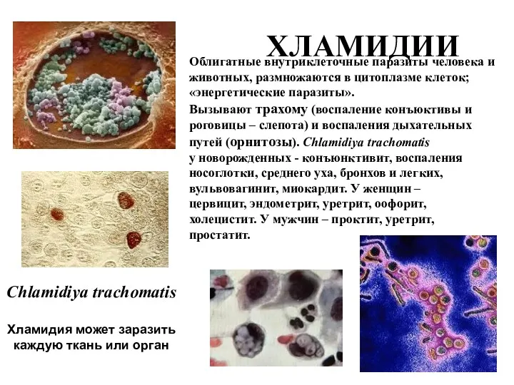 ХЛАМИДИИ Chlamidiya trachomatis Хламидия может заразить каждую ткань или орган
