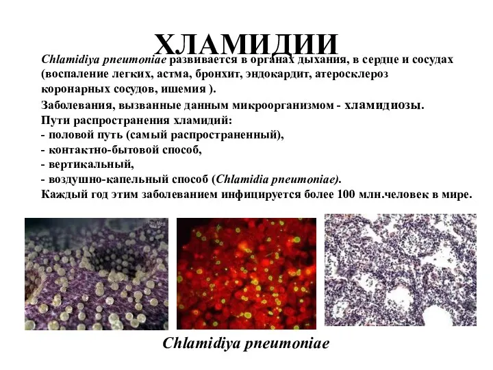 ХЛАМИДИИ Chlamidiya pneumoniae развивается в органах дыхания, в сердце и