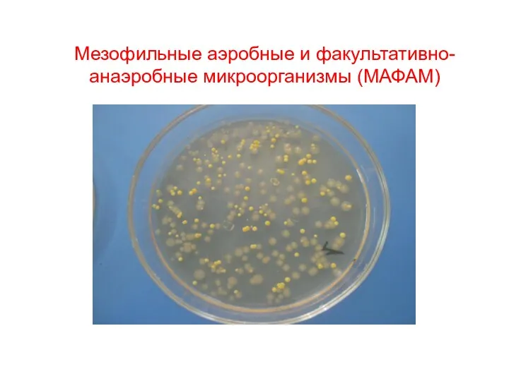 Мезофильные аэробные и факультативно-анаэробные микроорганизмы (МАФАМ)