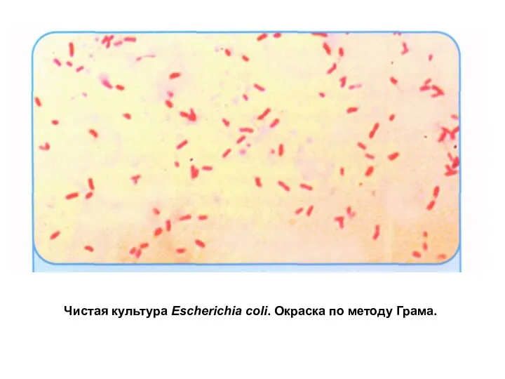 Чистая культура Escherichia coli. Окраска по методу Грама.