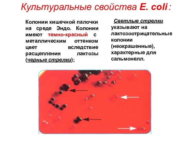 Светлые стрелки указывают на лактозоотрицательные колонии (неокрашенные), характерные для сальмонелл.