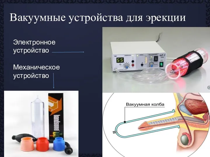 Вакуумные устройства для эрекции Электронное устройство Механическое устройство