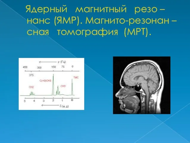 Ядерный магнитный резо – нанс (ЯМР). Магнито-резонан – сная томография (МРТ).