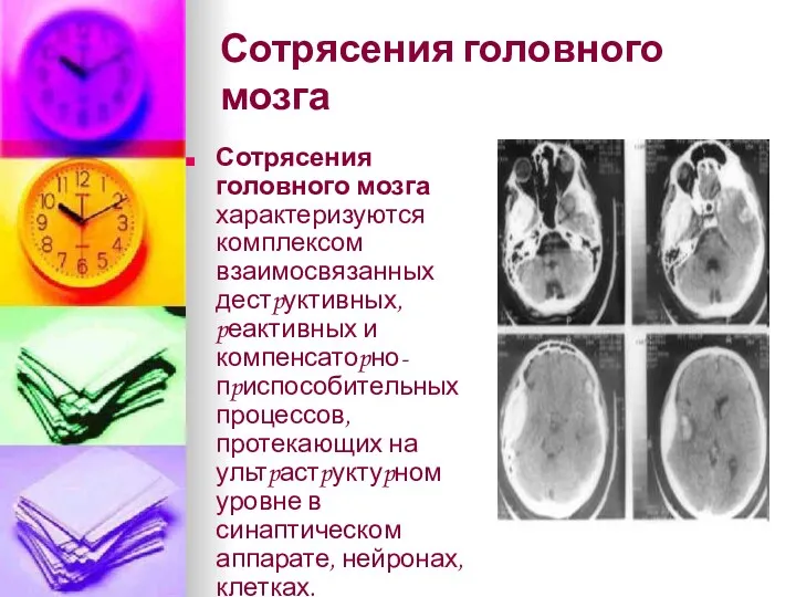 Сотрясения головного мозга Сотрясения головного мозга характеризуются комплексом взаимосвязанных дестpуктивных,